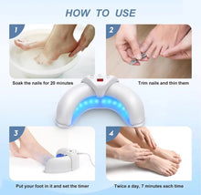 Load image into Gallery viewer, Nail Fungus Laser Device Toe Nail Fungus Treatment
