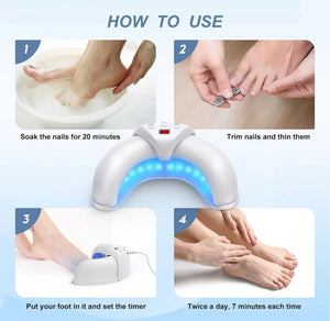 Nail Fungus Laser Device Toe Nail Fungus Treatment