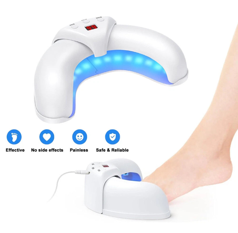 Nail Fungus Laser Device Toe Nail Fungus Treatment